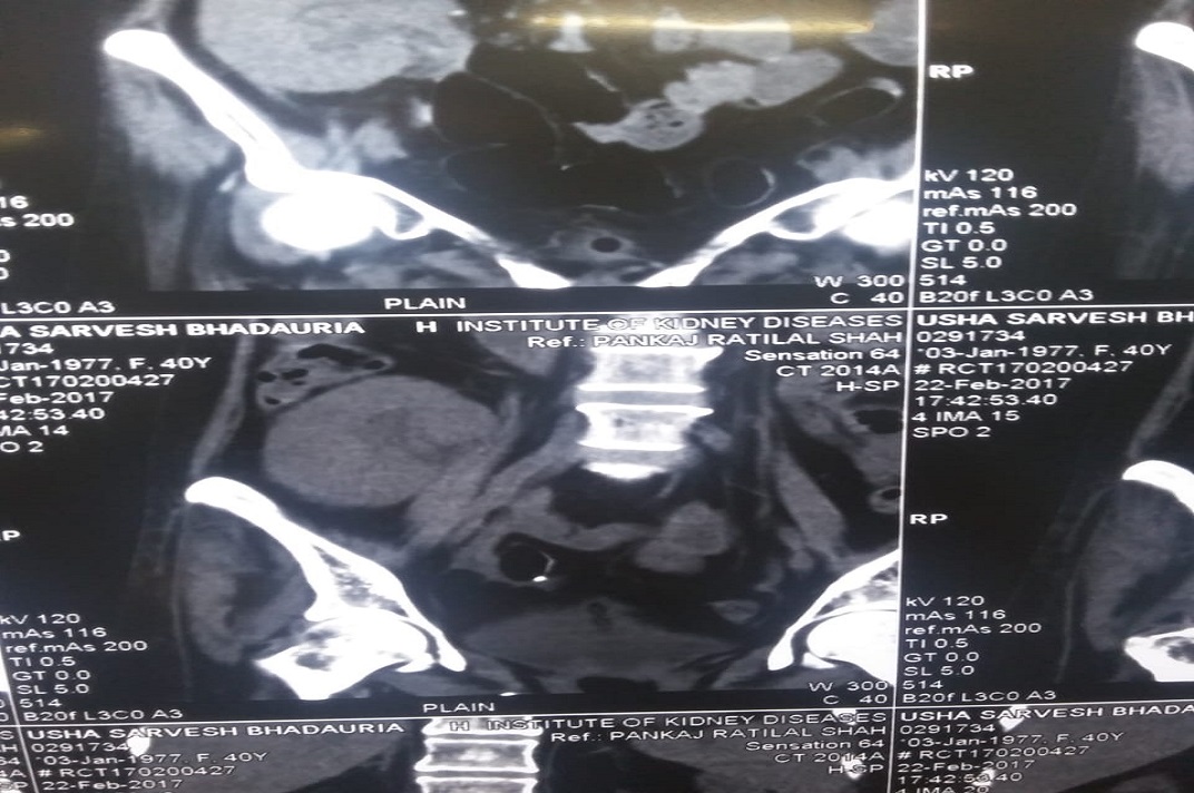 CT scan of the urinary system used for clinical evaluation