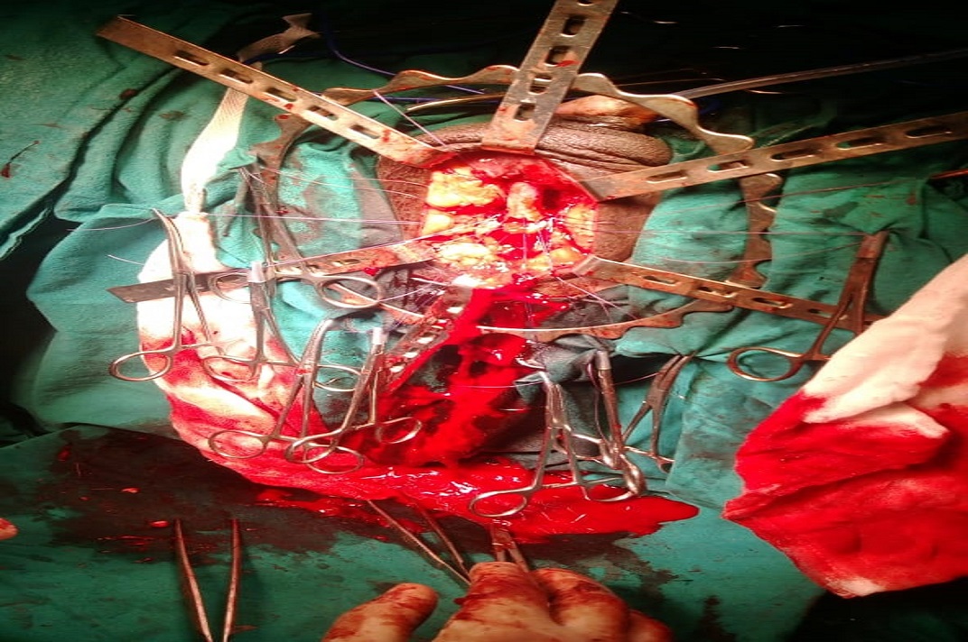 Urological surgical procedure performed by surgeons in an operating room