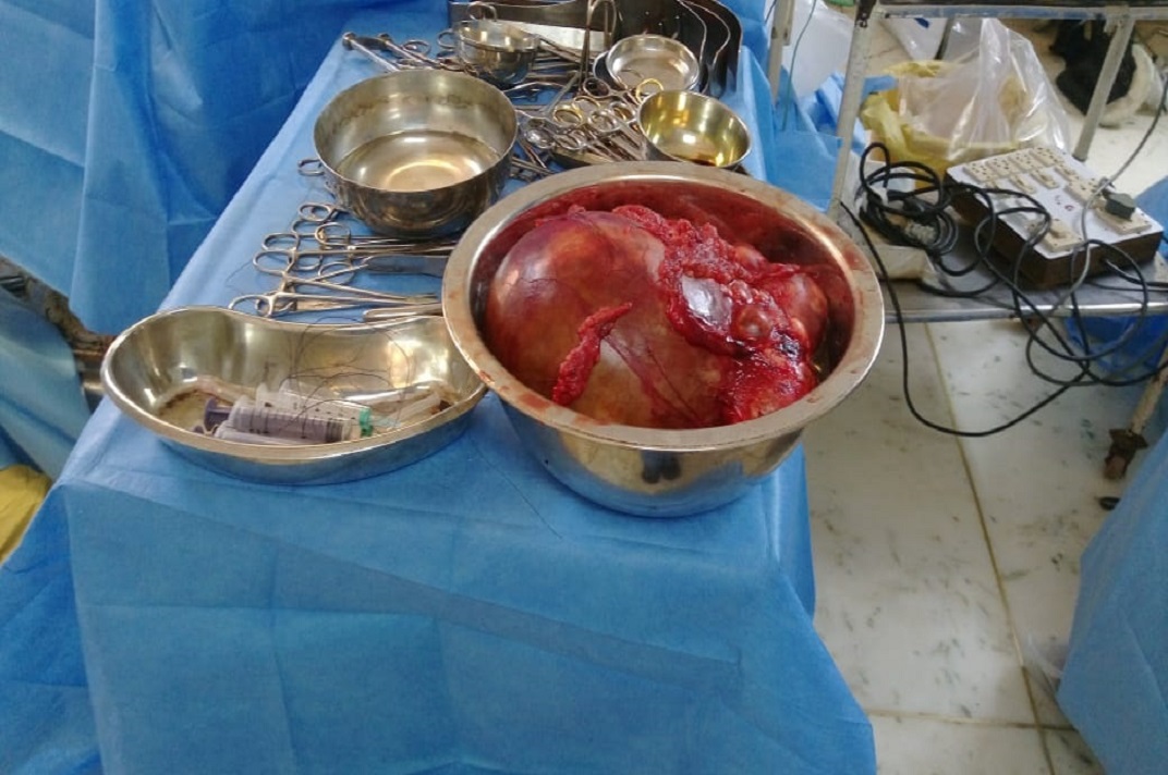 Surgical specimen and medical instruments prepared after a urological procedure