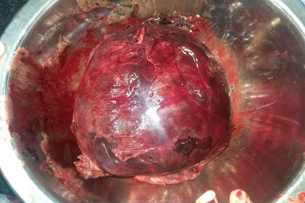 Kidney-related surgical procedure performed by a urology team