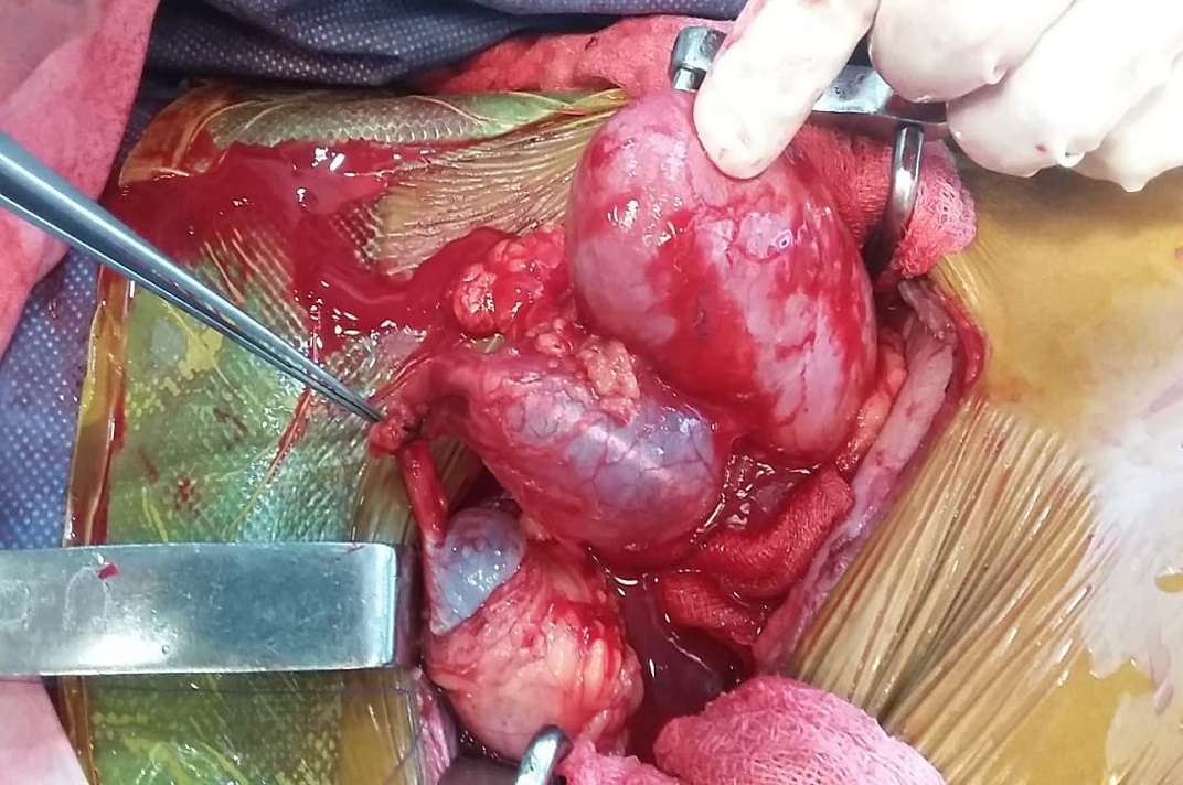 Advanced medical technology used for urological care